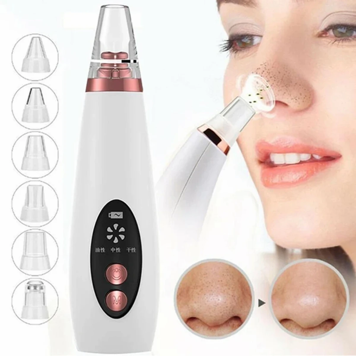 (ব্ল্যাকহেড রিমুভার যন্ত্র)Blackhead Remover Instrument Black Dot Remover Acne Vacuum Suction Face Clean Black Head Pore Cleaning Beauty Skin Care Tool